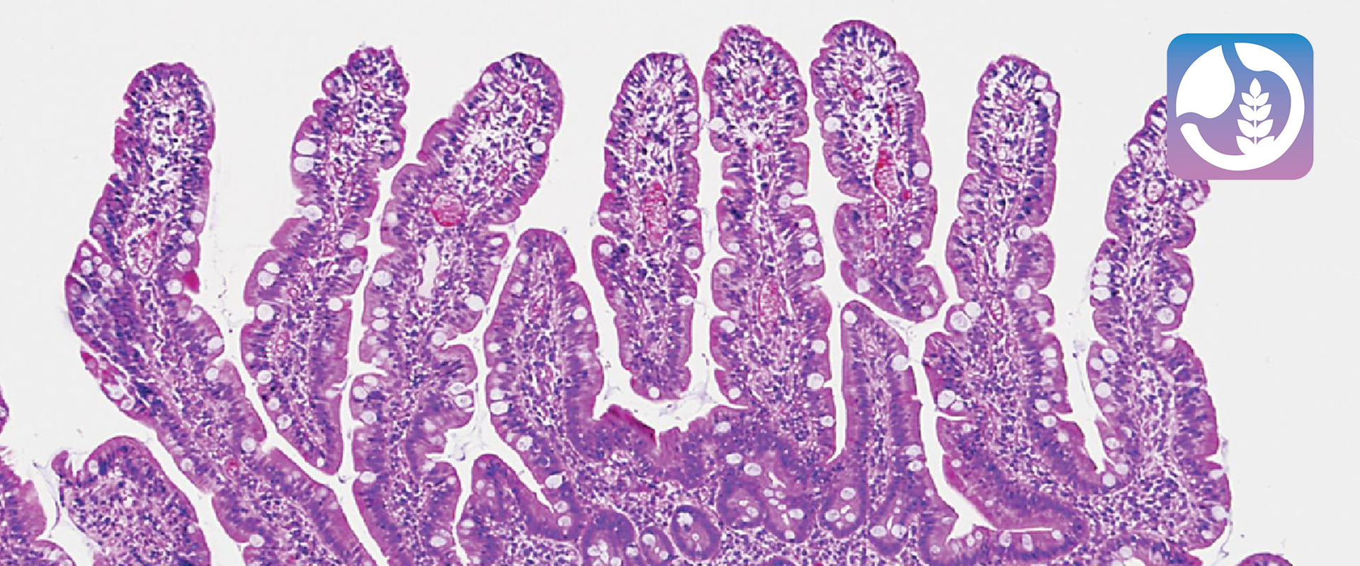 CeliachIA – analisi ingredienti con AI CeliachIA – schermata analisi ingredienti